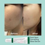 سرم ضد لک و درخشان‌کننده اکسیس وای(axis-y Dark Spot Correcting Glow Serum) - Image 2