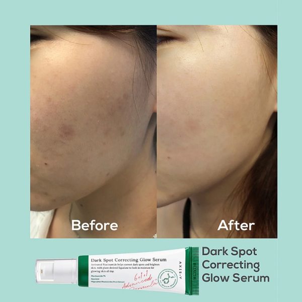 سرم ضد لک و درخشان‌کننده اکسیس وای(axis-y Dark Spot Correcting Glow Serum) - Image 2